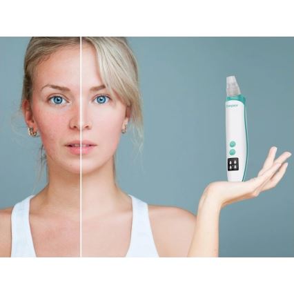 Beper - Aparat pentru curățarea porilor, reîncărcabil USB/5V 400 mAh