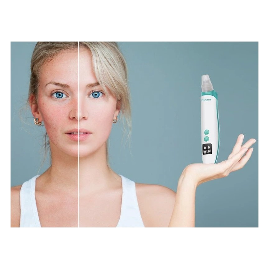 Beper - Aparat pentru curățarea porilor, reîncărcabil USB/5V 400 mAh